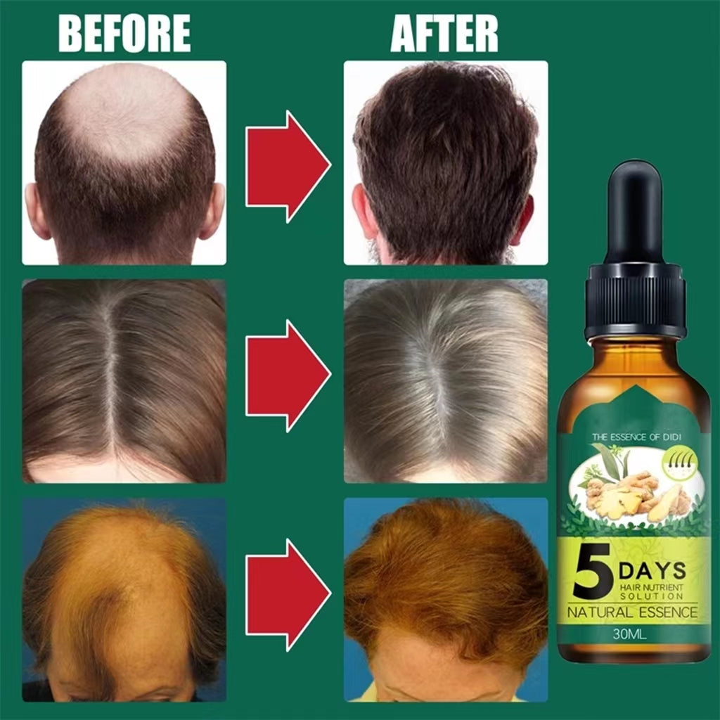 ✨ Sérum Repousse Cheveux 5 Days – Solution Naturelle Anti-Chute & Densité Renforcée