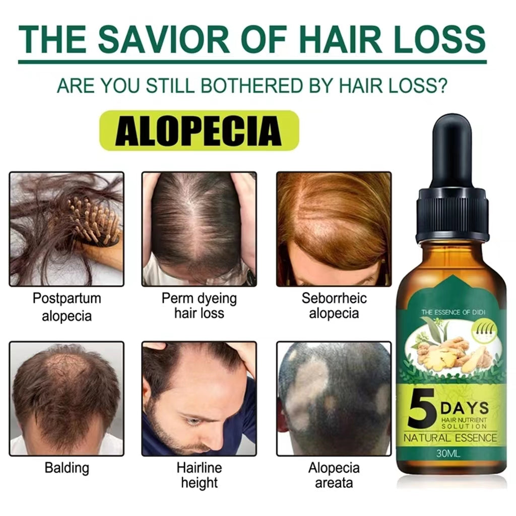 ✨ Sérum Repousse Cheveux 5 Days – Solution Naturelle Anti-Chute & Densité Renforcée