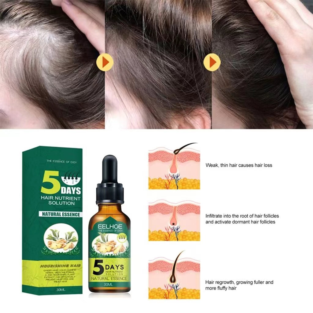 ✨ Sérum Repousse Cheveux 5 Days – Solution Naturelle Anti-Chute & Densité Renforcée